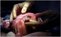 Fromtheuterusoutofthehopeofthehand2.jpg Fromtheuterusoutofthehopeofthehand2.jpg