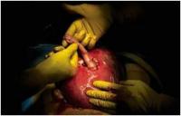 Fromtheuterusoutofthehopeofthehand3.jpg Fromtheuterusoutofthehopeofthehand3.jpg