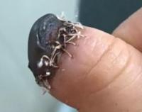 Necroticfingerisreturnedmiraclecontinuestogrowwell4.jpg Necroticfingerisreturnedmiraclecontinuestogrowwell4.jpg