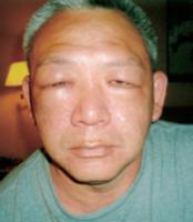 FacialdeformationWeiQiMingLay.jpg FacialdeformationWeiQiMingLay.jpg
