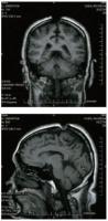 GarKingOpenTopscans.jpg